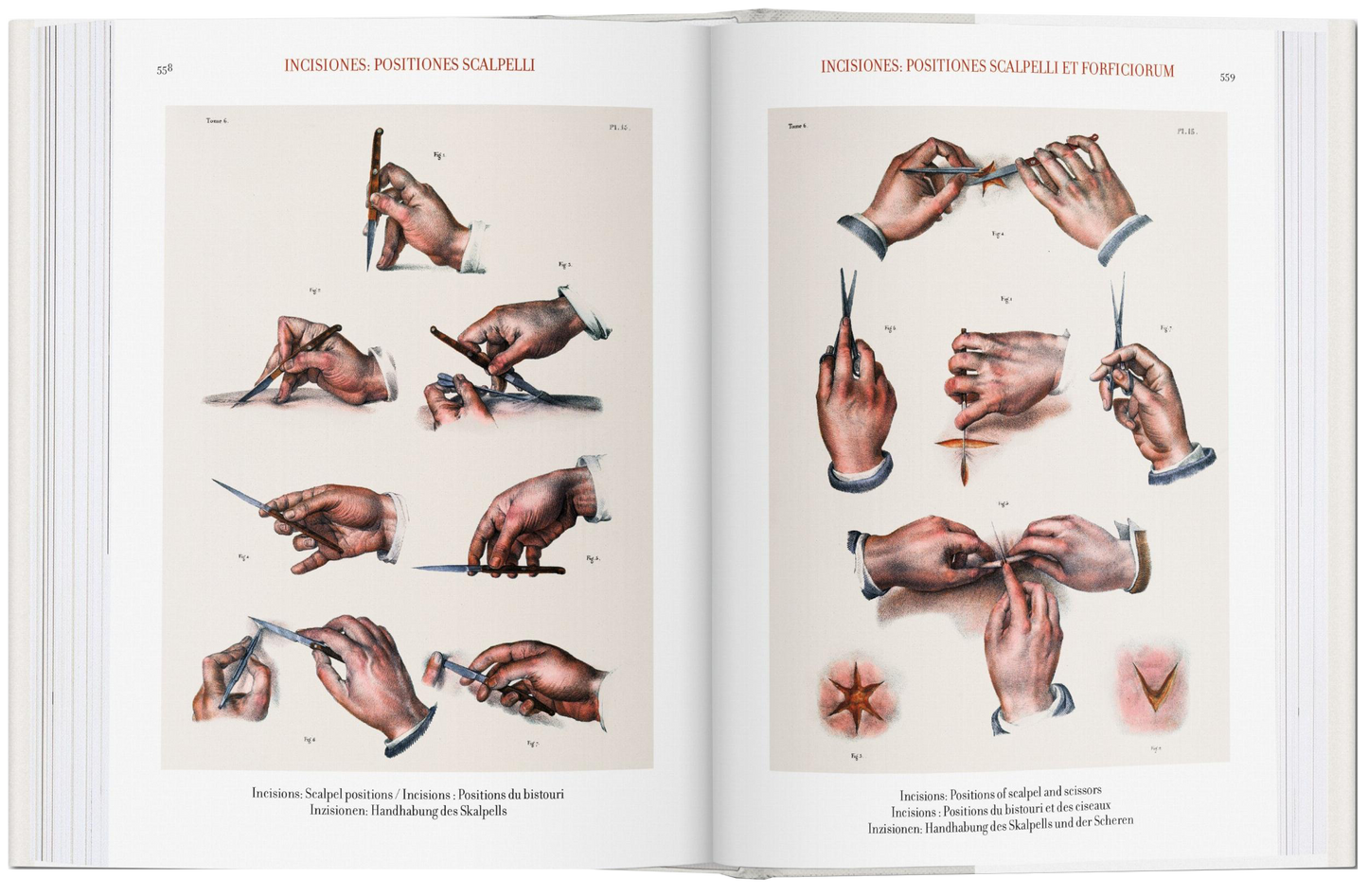Bourgery. Atlas of Human Anatomy and Surgery